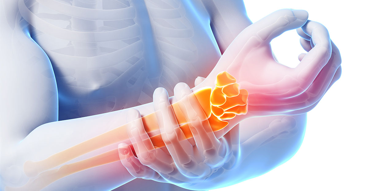 Depew natural carpal tunnel treatment