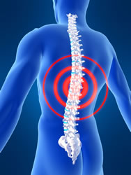 Back Pain Treatment Depew NY