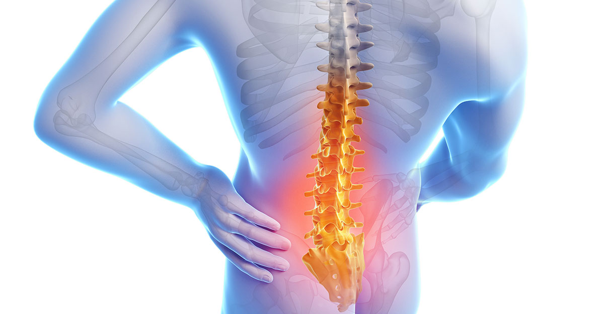 Depew Back Pain Treatment without Surgery
