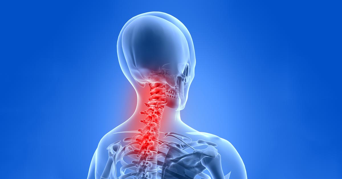 Depew car accident and neck pain treatment